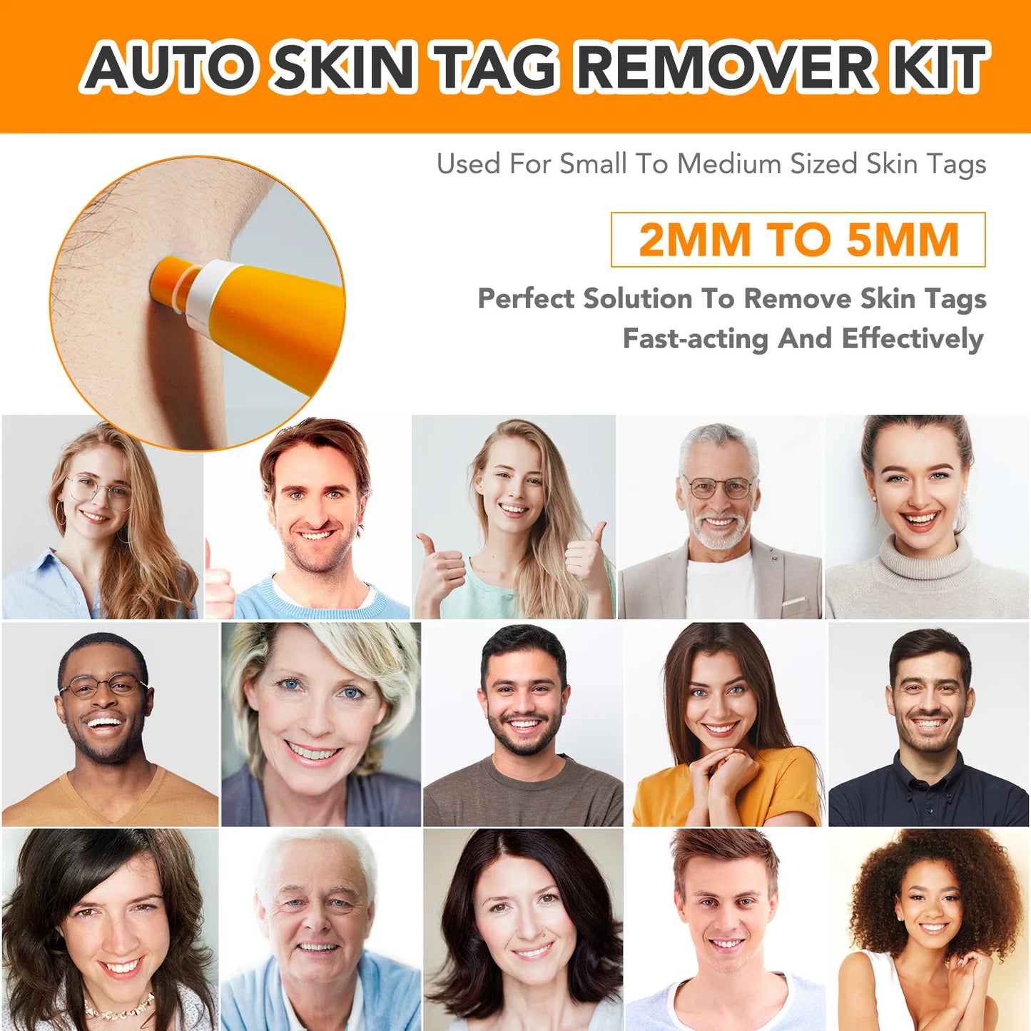 Skin Tag Relief Kit™